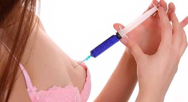 Pagdugang sa suso nga adunay hyaluronic acid injection